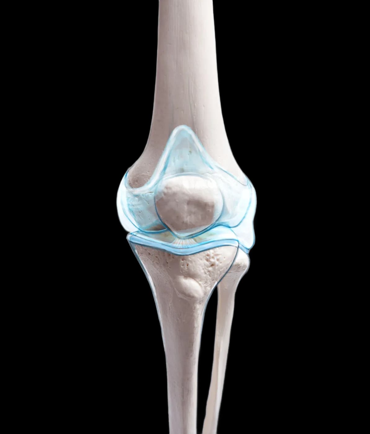 Modelo anatómico de rodilla — registro de tratamientos ortobiológicos en traumatología con OrthoData